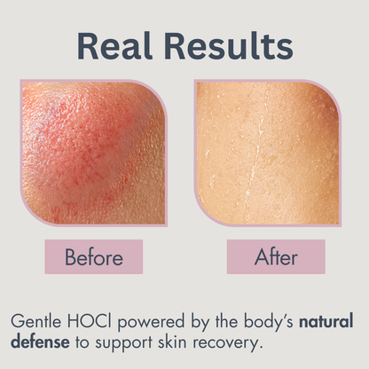 Hyphochlorous Pumping Spray + Nipple Care 4oz